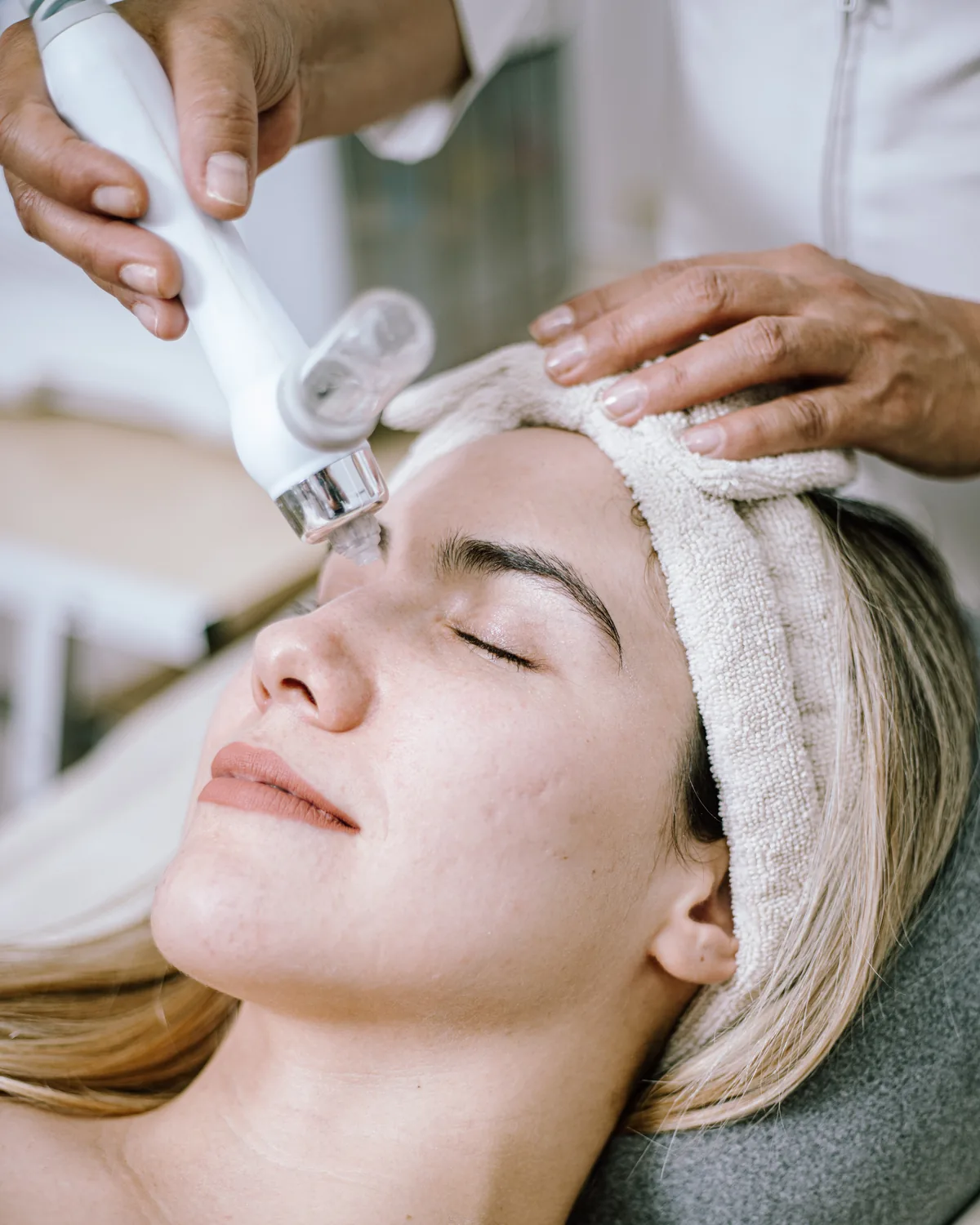 Procedimiento facial realizado en Acné Faciales Irapuato